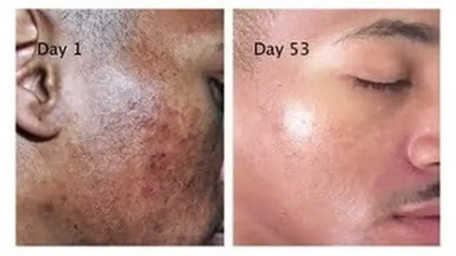 Person face wey sun don spoil.