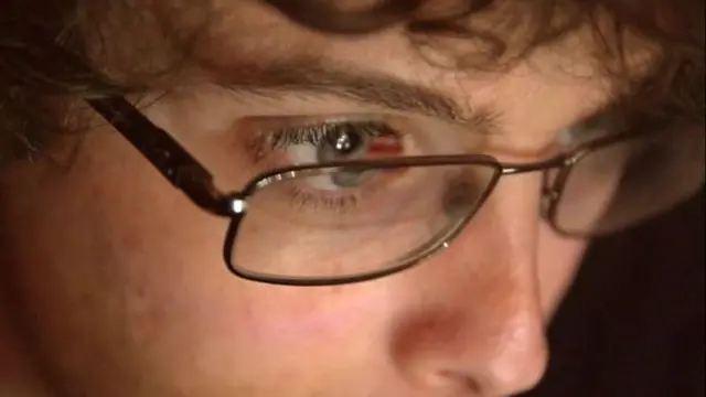 ஆட்டிசம் குறைப்பாடு