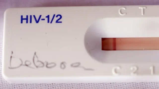 எச்.ஐ.வி