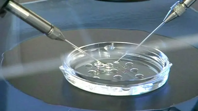 Embrioni u laboratorijskoj posudi