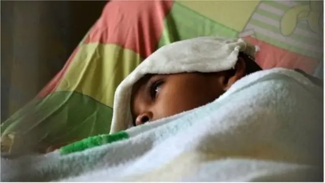 শিশু থেকে বয়স্ক -বিভিন্ন পরিবারে একাধিক ব্যক্তি আক্রান্ত হচ্ছে চিকুনগুনিয়ায়।