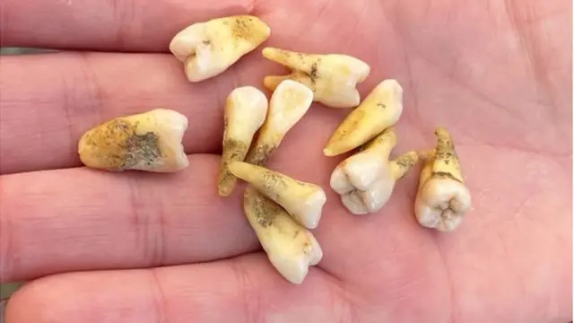 Watts sürekli ağrılarla yaşadığını, dış görünüşünün ve konuşmasının etkilendiğini söylüyor