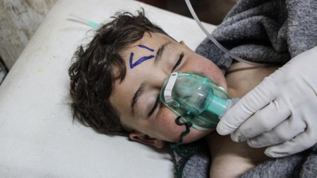 Ребенок в больнице после химической атаки в Хан-Шейхуне в 2017 году
