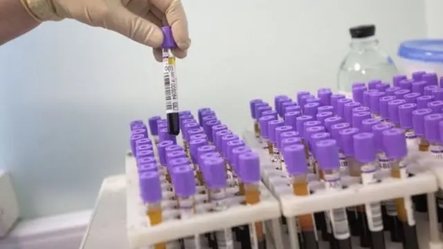 બ્લડ સૅમ્પલ