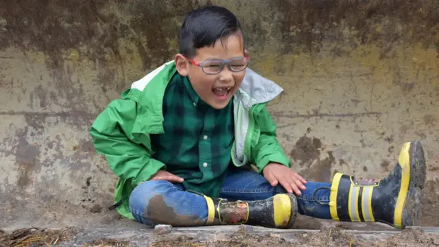 1980년대 이래로, 일부 과학자들은 아이들이 더러운 환경에서 노는 게 건강한 면역 체계를 만드는데 도움이 된다고 생각해왔다