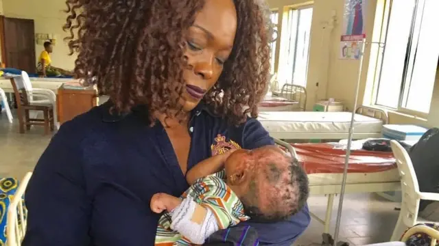 Fondacija Ibi Ikotidem pomaže da se plate bolnički računi za decu