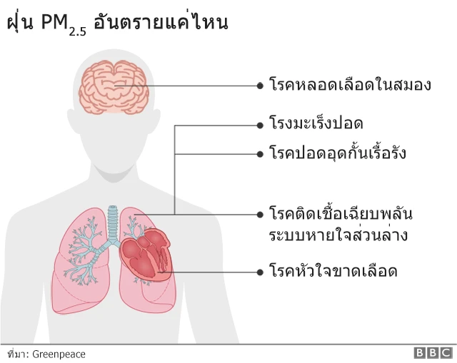 กราฟฟิค