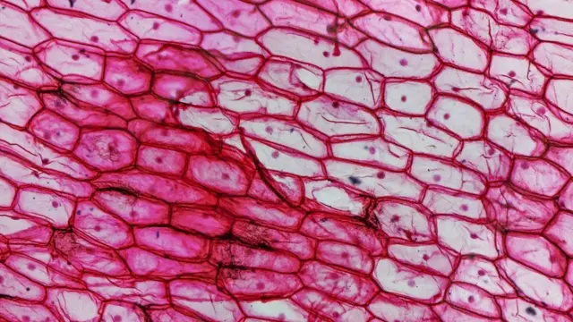 પ્રતીકાત્મક તસવીર