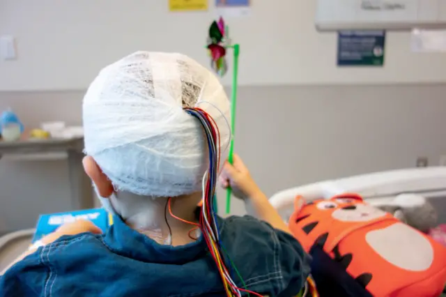 Un niño con cables sobre cabeza vendada