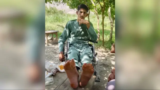 د احسان الله د پښو پنځه ګوتې تورې شوې وې چې وروسته ډاکټرانو ترې غوڅې کړې.