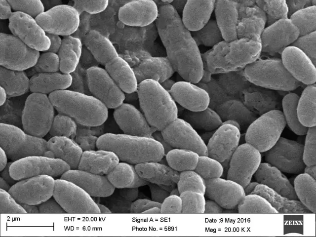 मिथेन खाणारा जीवाणू मायक्रोस्कोपमधून असा दिसतो