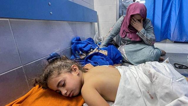 Una niña herida por los ataques aéreos israelíes es tratada en el hospital al-Shifa.