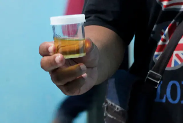 กล่องบรรจุปัสสาวะ