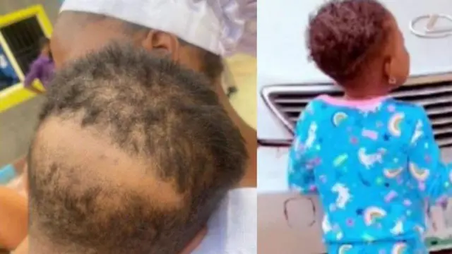 Ipakọ ọmọ ti wọn fa irun rẹ