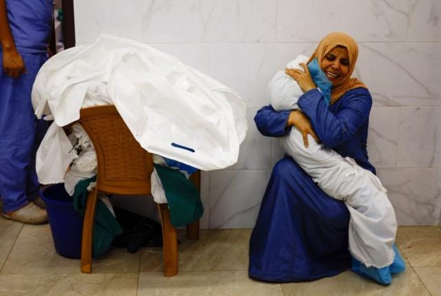 أطباء يقولون إن 40 في المئة من المصابين في مستشفى غزة أطفال