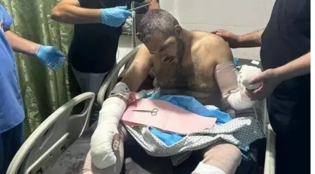 سال گذشته شبه‌نظامیان نقابدار امین عابد، منتقد قدیمی حماس، را مورد ضرب و شتم قرار دادند. او اکنون در دوبی زندگی می‌کند