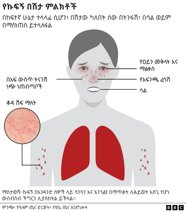 የሰውነት ክፍሎች