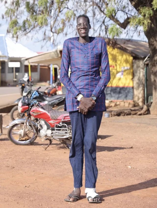 Doctors say de 9.6 feet tall giant from Ghana get gigantism