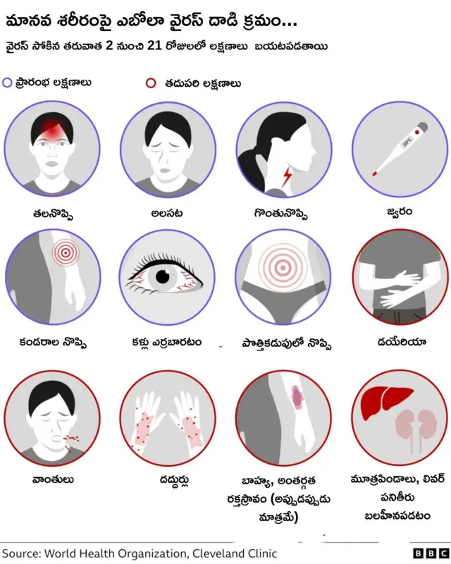 ఎబోలా వైరస్ లక్షణాలు