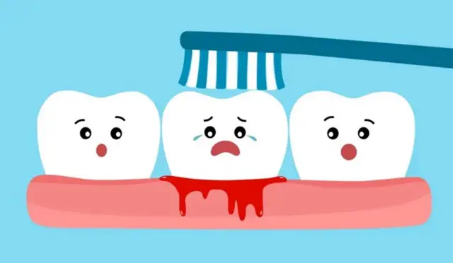 મોંનું આરોગ્ય એટલે શું?, બીબીસી ગુજરાતી, ડેન્ટિસ્ટ, દાંતનો દુખાવો