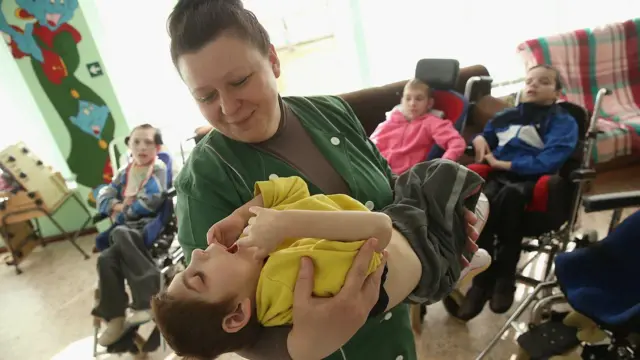 Pripisivanje efekata izloženosti zračenju iz Černobilja urođenim manama i drugim zdravstvenim problemima kod dece rođene nakon nesreće je kontroverzno