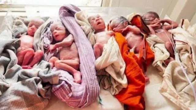 एकाच वेळी जन्मलेली पाच बाळं