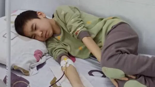 Бөбөк учурда тез арада сөөк чучугун алмаштырууга муктаж