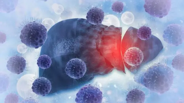 ਲਿਵਰ ਦੀ ਸੰਕੇਤਕ ਤਸਵੀਰ