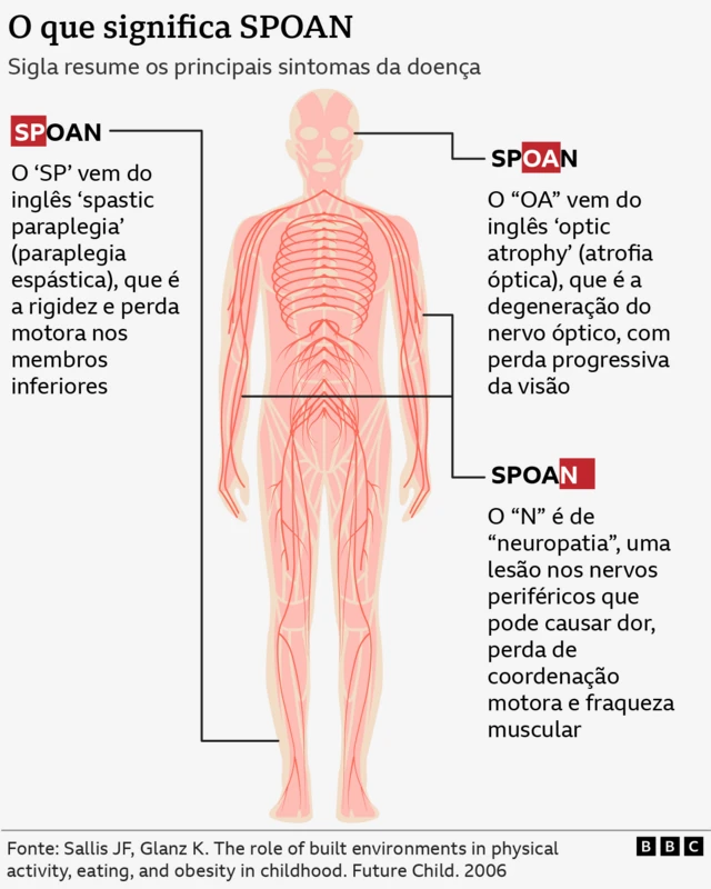 Gráfico mostra origem do nome da doença Spoan