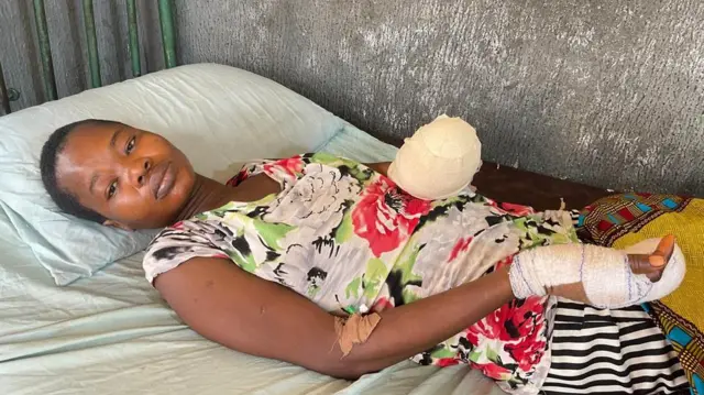 Nwaanyị di ya bepụrụ aka