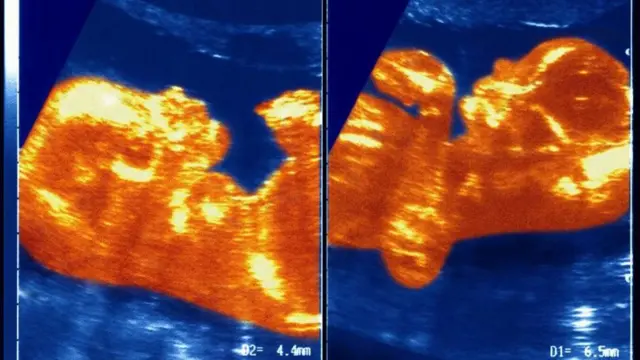 XX క్రోమోజోములు, XY క్రోమోజోములు, డీఎన్ఏ