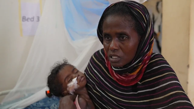 لم تستطع أن تنقذهما معا.. أم سودانية تضطر للاختيار بين علاج طفلتيها التوأم