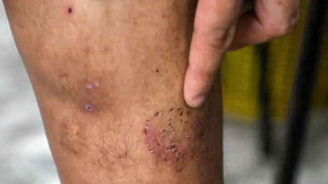 Foto, korban, pusat penipuan, online, Kamboja