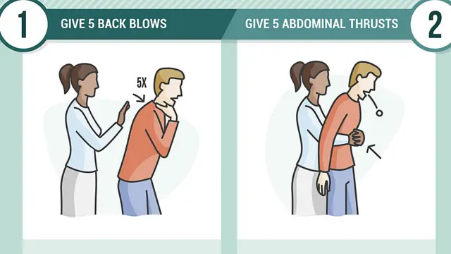 Cartel de instrucciones para primeros auxilios si alguien se atraganta