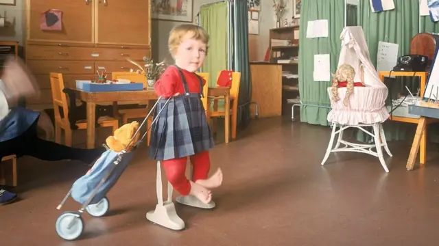 Niña con malformaciones genéticas a causa de la talidomida