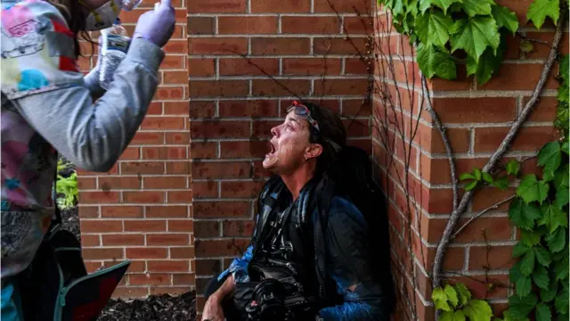 A medic helps a member of the media wash her eyes after tear gas was fire