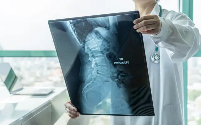 Una doctora, vestida con una bata blanca y con un estetoscopio alrededor del cuello, examina una radiografía que muestra la parte inferior de la columna vertebral de un paciente