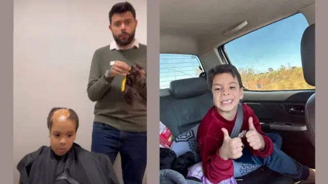 Lucas antes y después de recibir la prótesis capilar