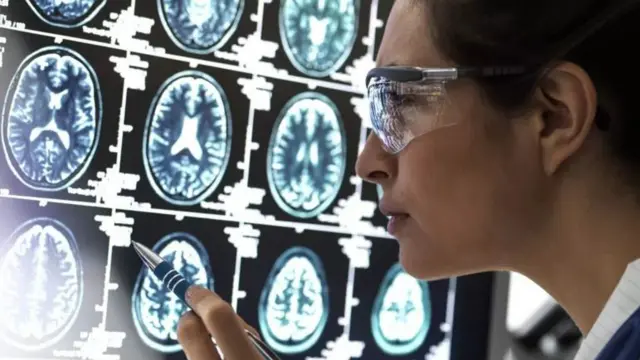 La recherche sur la maladie d'Alzheimer.