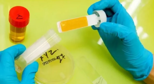 உடல்நலம்: ஆபத்தைக் குறிக்கும் சிறுநீரின் நிறம் - எப்போது எச்சரிக்கையாக இருக்க வேண்டும்?