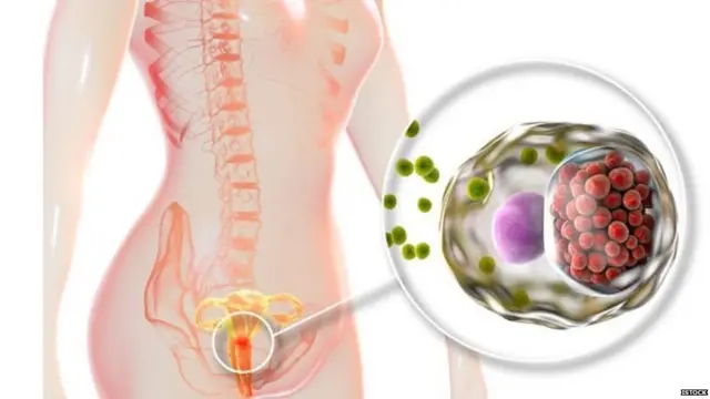 ਸੈਕਸੁਅਲ ਇਨਫੈਕਸ਼ਨ