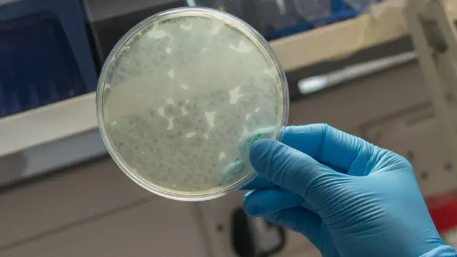 Close up of a petri dish held in a blue gloved hand