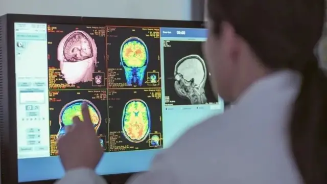 ٹرانسپلانٹ