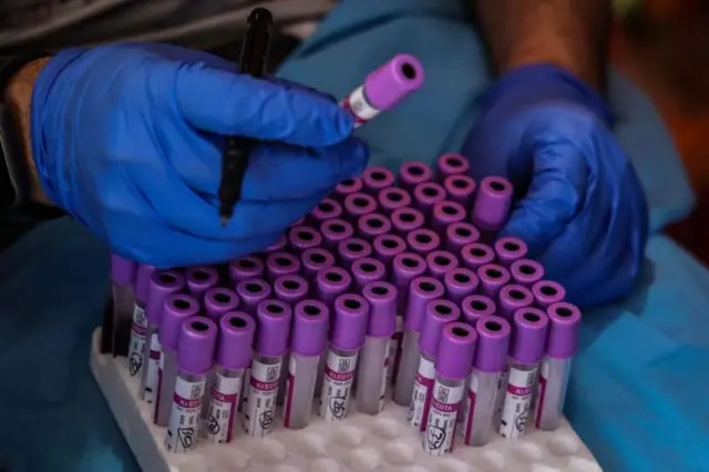 रक्तगट कसे तयार होतात, रक्तगटांबद्दल सर्वकाही जाणून घ्या - फिट जिंदगी