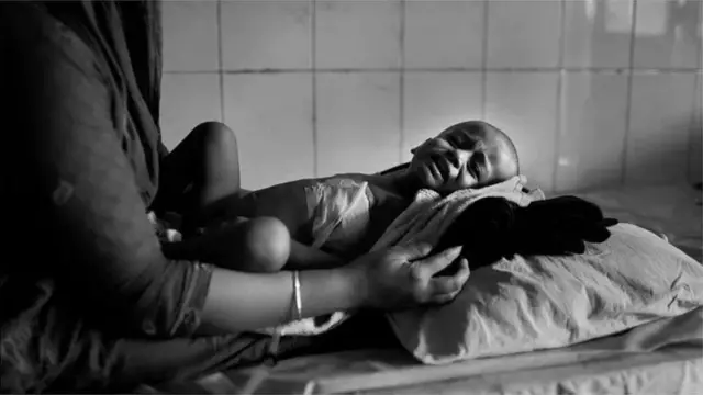 Watoto wako katika hatari ya kupuuza matibabu ya kifua kikuu.