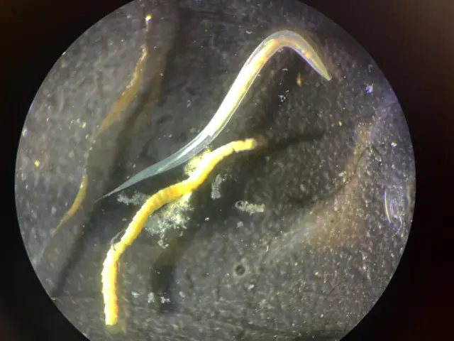 වඳුරන්ගෙන් හා රිලවුන්ගෙන් මෙම පටිපණුවන් ව්‍යාප්ත වන බව වෛද්‍ය විශේෂඥයෝ පවසති.