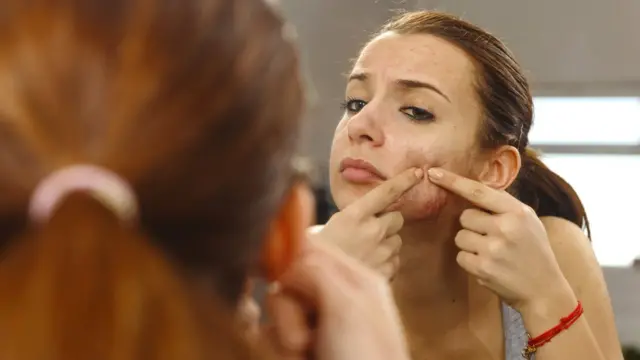 Una joven se explota un grano de la cara.