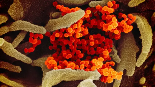 This scanning electron microscope image shows SARS-CoV-2 -also known as 2019-nCoV, the virus that causes COVID-19-isolated from a patient in the U.S., emerging from the surface of cells cultured in the lab.