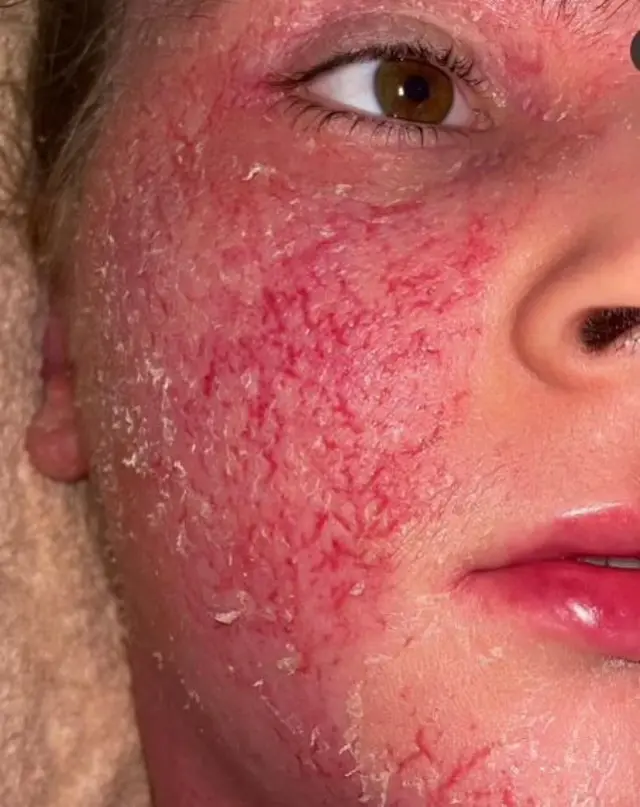 ਬੈਥਨੀ ਗੈਂਬਲ