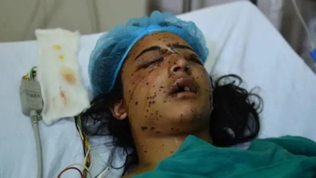 पैलट गन से ज़ख्मी लड़की